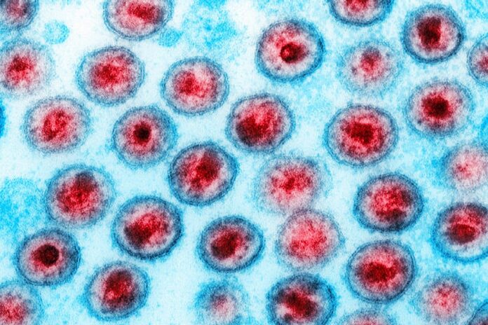 Medicamento de câncer reduz células infectadas por HIV em estudo